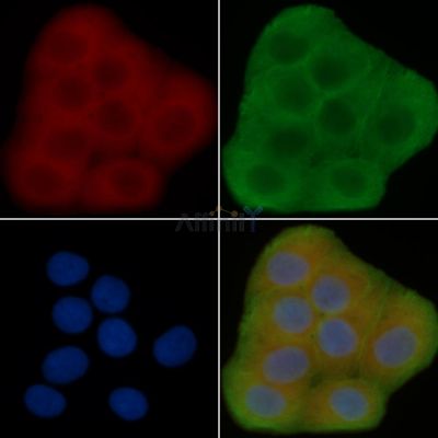 p23 Antibody - AF6794 staining Hela cells(30min of UV treatment) by IF/ICC.