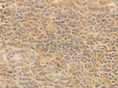 NF-kB p65 Antibody - AF6795 at 1/100 staining human normal tonsil tissue by IHC-P.