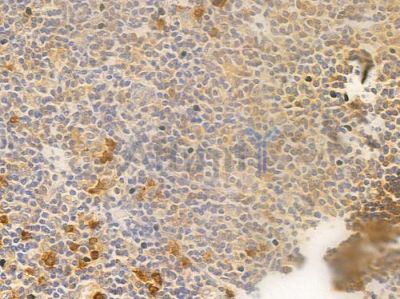 MKK3/MKK6 Antibody - AF6804 at 1/100 staining human normal tonsil tissue by IHC-P.