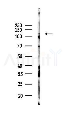 JIP1 Antibody - Western blot analysis of lysates from B16F10-LUC cells(UV 30min treatment), using JIP1 Antibody at 1/1000 dilution.