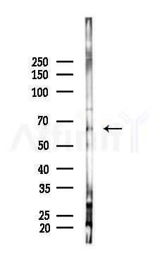 Perilipin-1 Antibody - Western blot analysis of lysates from Mouse lung, using Perilipin-1 Antibody at 1/1000 dilution.
