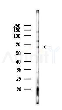 Perilipin-1 Antibody - Western blot analysis of lysates from K562 cells(UV 30min treatment), using Perilipin-1 Antibody at 1/1000 dilution.