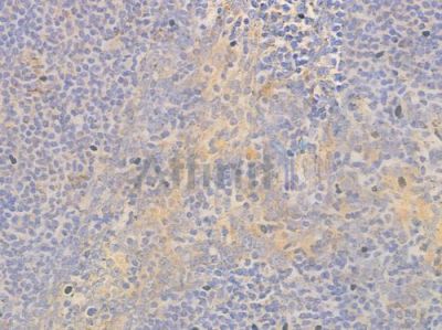 HGS Antibody - AF6861 at 1/100 staining human normal tonsil tissue by IHC-P.