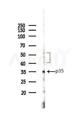 Caspase 9 Antibody - Western blot analysis of lysates from K562 cells(UV 30min treatment), using Caspase 9 Antibody at 1/1000 dilution.