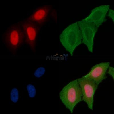 MCM2 Antibody - AF6877 staining Hela cells(30min of UV treatment) by IF/ICC.