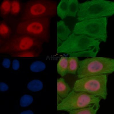 MCM2 Antibody - AF6880 staining Hela cells(30min of UV treatment) by IF/ICC.