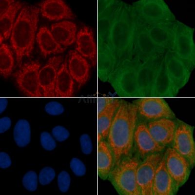 MLKL Antibody - AF6905 staining Hela cells(30min of UV treatment) by IF/ICC.
