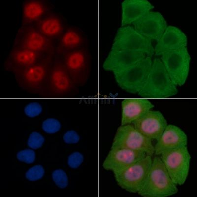RUNX1 / AML1 Antibody - AF6934 staining Hela cells(30min of UV treatment) by IF/ICC.