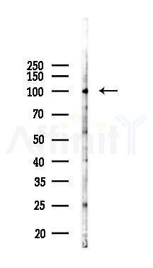 Integrin beta 1 Antibody - Western blot analysis of lysates from B16F10-LUC cells(UV 30min treatment), using Integrin beta 1 Antibody at 1/1000 dilution.
