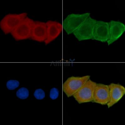 TIMP4 Antibody - AF7009 staining Hela cells(24h of starvation treatment) by IF/ICC.