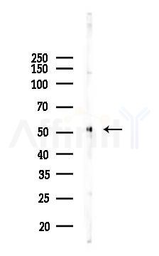 Vimentin Antibody - Western blot analysis of lysates from B16F10-LUC cells(UV 30min treatment), using Vimentin Antibody at 1/1000 dilution.