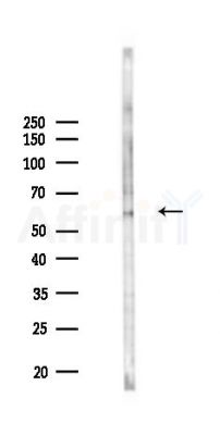 Phospho-SLC22A8 (Ser4) Antibody - Western blot analysis of lysates from Rat brain, using Phospho-SLC22A8 (Ser4) Antibody at 1/1000 dilution.