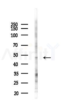Phospho-MKK7 (Ser271/Thr275) Antibody - Western blot analysis of lysates from EC304 cells(starvation 24h treatment), using Phospho-MKK7 (Ser271/Thr275) Antibody at 1/1000 dilution.