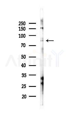 Phospho-MSK2 (Thr687) Antibody - Western blot analysis of lysates from EC304 cells(starvation 24h treatment), using Phospho-MSK2 (Thr687) Antibody at 1/1000 dilution.