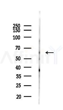 Phospho-Lck (Tyr192) Antibody - Western blot analysis of lysates from Mouse brain, using Phospho-Lck (Tyr192) Antibody at 1/1000 dilution.