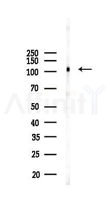 Phospho-GAB1 (Tyr406) Antibody - Western blot analysis of lysates from B16F10-LUC cells(UV 30min treatment), using Phospho-GAB1 (Tyr406) Antibody at 1/1000 dilution.