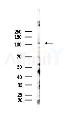 Phospho-GAB1 (Tyr659) Antibody - Western blot analysis of lysates from Mouse lung, using Phospho-GAB1 (Tyr659) Antibody at 1/1000 dilution.