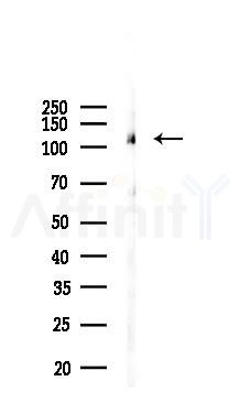 Phospho-PYK2 (Tyr579/Tyr580) Antibody - Western blot analysis of lysates from B16F10-LUC cells(UV 30min treatment), using Phospho-PYK2 (Tyr579/Tyr580) Antibody at 1/1000 dilution.