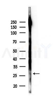 Phospho-LIN28A (Ser200) Antibody - Western blot analysis of lysates from EC304 cells(starvation 24h treatment), using Phospho-LIN28A (Ser200) Antibody at 1/1000 dilution.