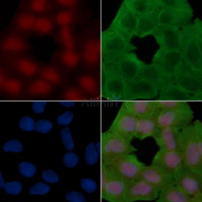 SKI Antibody - AF7536 staining Hela cells(30min of UV treatment) by IF/ICC.