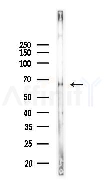 KISS1R Antibody - Western blot analysis of lysates from B16F10-LUC cells(UV 30min treatment), using KISS1R Antibody at 1/1000 dilution.
