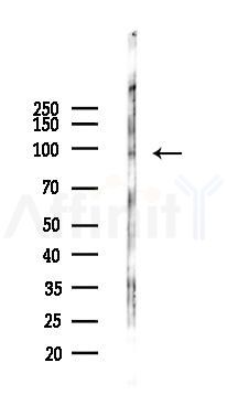 NOTCH3 Antibody - Western blot analysis of lysates from Hela cells(starvation 24h treatment), using NOTCH3 Antibody at 1/1000 dilution.