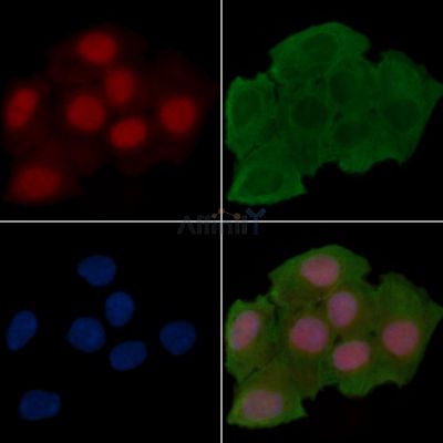 osterix Antibody - AF7580 staining Hela cells(30min of UV treatment) by IF/ICC.