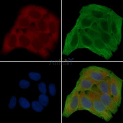 Annexin A2 Antibody - AF7596 staining Hela cells(30min of UV treatment) by IF/ICC.