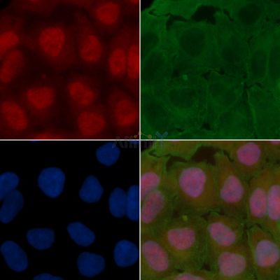 MDM4 Antibody - AF7609 staining Hela cells(30min of UV treatment) by IF/ICC.