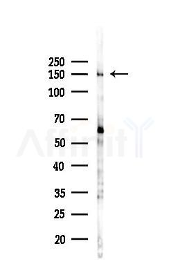 NFAT5 Antibody - Western blot analysis of lysates from B16F10-LUC cells(UV 30min treatment), using NFAT5 Antibody at 1/1000 dilution.