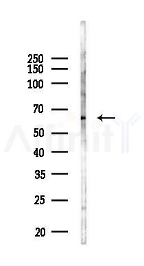 OSR1 Antibody - Western blot analysis of lysates from PC12 cells(LPS 4h treatment), using OSR1 Antibody at 1/1000 dilution.