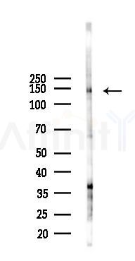 APP Antibody - Western blot analysis of lysates from Hela cells(starvation 24h treatment), using APP Antibody at 1/1000 dilution.