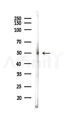 Lck Antibody - Western blot analysis of lysates from Rat brain, using Lck Antibody at 1/1000 dilution.
