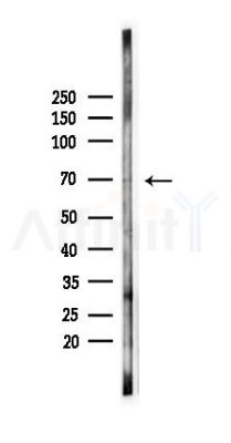 ADRB2 Antibody - Western blot analysis of lysates from PC12 cells(starvation 24h treatment), using ADRB2 Antibody at 1/1000 dilution.