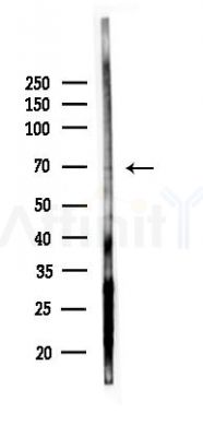 ADRB2 Antibody - Western blot analysis of lysates from EC304 cells(starvation 24h treatment), using ADRB2 Antibody at 1/1000 dilution.