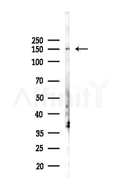 CFTR Antibody - Western blot analysis of lysates from B16F10-LUC cells(UV 30min treatment), using CFTR Antibody at 1/1000 dilution.