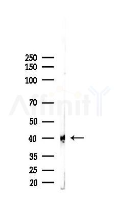 FRA1 Antibody - Western blot analysis of lysates from EC304 cells(starvation 24h treatment), using FRA1 Antibody at 1/1000 dilution.