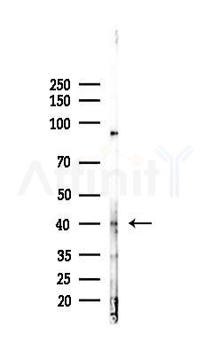 CEBP Beta Antibody - Western blot analysis of lysates from EC304 cells(starvation 24h treatment), using CEBP Beta Antibody at 1/1000 dilution.
