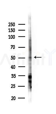 GATA2 Antibody - Western blot analysis of lysates from EC304 cells(starvation 24h treatment), using GATA2 Antibody at 1/1000 dilution.
