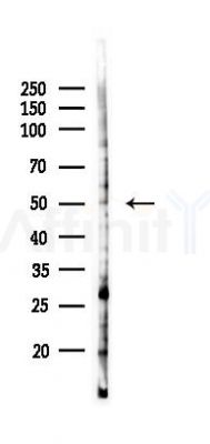 GATA3 Antibody - Western blot analysis of lysates from K562 cells(UV 30min treatment), using GATA3 Antibody at 1/1000 dilution.