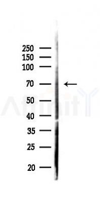 SHP1 Antibody - Western blot analysis of lysates from K562 cells(UV 30min treatment), using SHP1 Antibody at 1/1000 dilution.