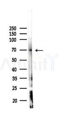 MARCKS Antibody - Western blot analysis of lysates from K562 cells(UV 30min treatment), using MARCKS Antibody at 1/1000 dilution.