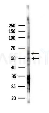 CDC25C Antibody - Western blot analysis of lysates from EC304 cells(starvation 24h treatment), using CDC25C Antibody at 1/1000 dilution.