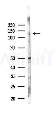 AXL Antibody - Western blot analysis of lysates from EC304 cells(starvation 24h treatment), using AXL Antibody at 1/1000 dilution.