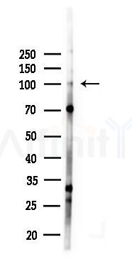 MCM4 Antibody - Western blot analysis of lysates from EC304 cells(starvation 24h treatment), using MCM4 Antibody at 1/1000 dilution.