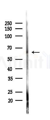 WASP Antibody - Western blot analysis of lysates from Mouse lung, using WASP Antibody at 1/1000 dilution.