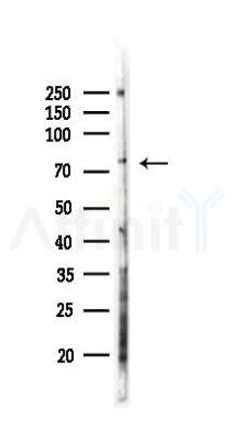 RSK2 Antibody - Western blot analysis of lysates from K562 cells(UV 30min treatment), using RSK2 Antibody at 1/1000 dilution.