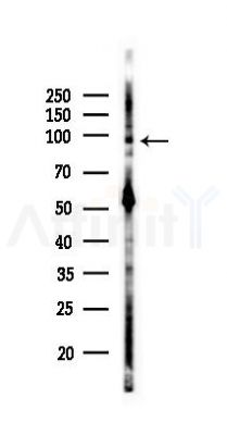 RSK2 Antibody - Western blot analysis of lysates from K562 cells(UV 30min treatment), using RSK2 Antibody at 1/1000 dilution.