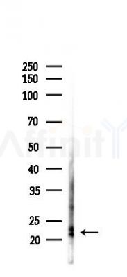 Rac1/cdc42 Antibody - Western blot analysis of lysates from Mouse lung, using Rac1/cdc42 Antibody at 1/1000 dilution.