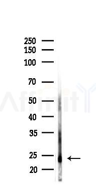 Rac1/cdc42 Antibody - Western blot analysis of lysates from Rat brain, using Rac1/cdc42 Antibody at 1/1000 dilution.